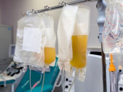 leukapheresis vs apheresis