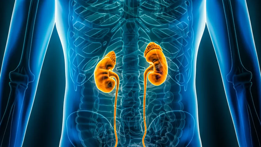 acute kidney injury
