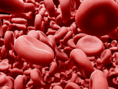 red blood cell exchange